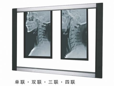 點擊查看詳細信息<br>標題：LED觀片燈 閱讀次數(shù)：2005